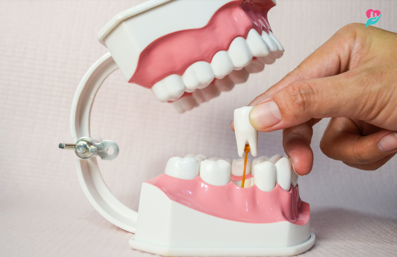 how can i make my tooth extraction heal faster