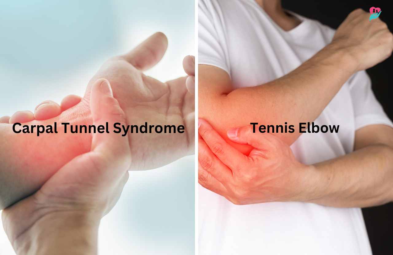 carpal tunnel vs tennis elbow